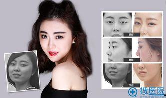 明星指定整形医院,揭秘XXX整形医院背后的魅力与实力